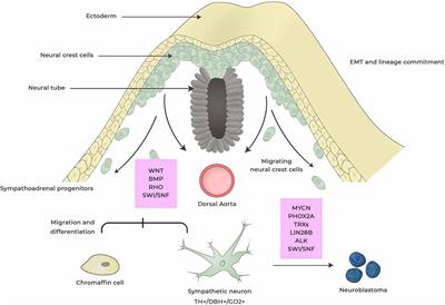 Neuroblastoma—A Neural Crest Derived Embryonal Malignancy